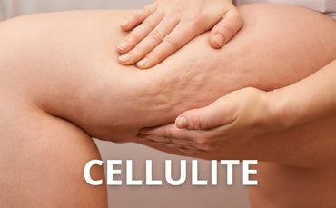Cellulite: cause, rimedi naturali e la crema anticellulite migliore